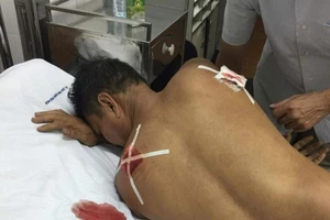 Bị chém trọng thương vì qua... nhắc nhở hàng xóm