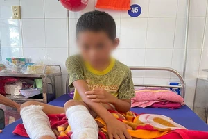 Cha lấy xăng, rơm đốt 2 chân con vì nghe tin con ăn trộm tiền hàng xóm