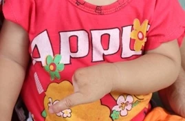 Kỳ lạ gia tộc 4 đời chỉ có một ngón tay, chân