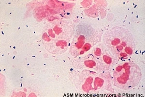 Kẻ gây vô sinh giấu mặt và bất ngờ