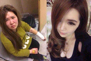Thiếu nữ bị bạn trai đánh dã man vì xấu hơn trên mạng