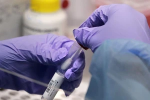 Mỹ ghi nhận trường hợp đầu tiên nhiễm biến thể Omicron. Ảnh: AP