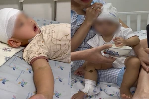 1 người bị bắt vì gây thương tích 46% cho trẻ 14 tháng tuổi