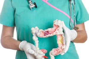 BV Thủ Đức điều trị thành công đa khối u ruột già