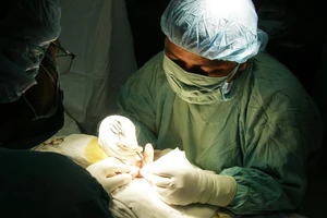 Mất khả năng cầm và nắm do bỏ trị liệu