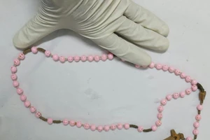 Chuỗi hạt dài 80cm trong thực quản cụ ông