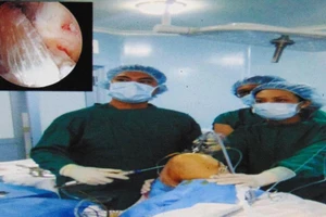 BV Củ Chi mổ nội soi tái tạo dây chằng chéo 