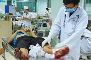 Rách da, gãy chân từ miếng gác chân xe máy