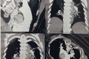 Bỗng dưng mất ý thức đột ngột, hãy đến bệnh viện ngay 