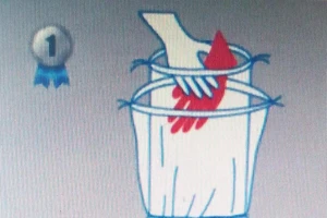 Mất tay, chân do bảo quản không đúng phần đứt lìa 