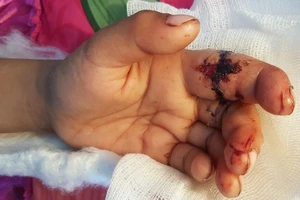 Đúng là 'chơi dao có ngày đứt tay'!