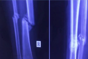 BV lớn 'bó tay', BV quận xử lý ngon ơ