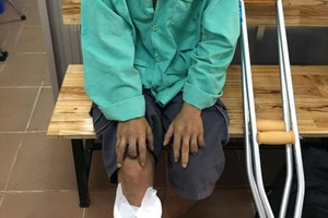 Tay chân 'bốc hơi' theo… khói thuốc lá