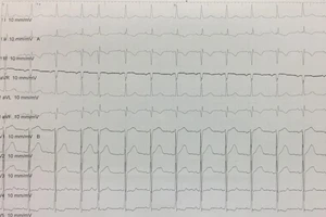 Chuyên gia Pháp 'bó tay', bác sĩ Việt trổ tài