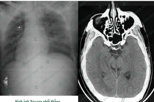 Tài xế hôn mê sâu khi lái xe chỉ vì quên ăn sáng