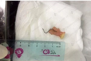 Sặc... răng giả khi đang chạy xe máy