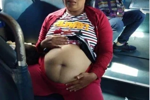 Thấp thỏm sợ bị phạt vì chở bà bầu giả đi sinh