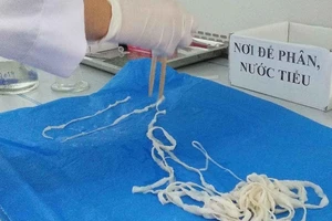Hoảng hồn sán dây dài trên 5m 'ẩn' trong người cô gái