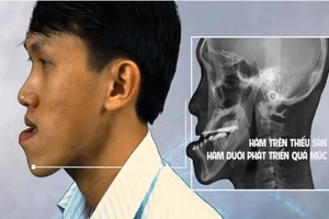 Điều trị lệch xương hàm vào chung khảo Sáng tạo TP.HCM