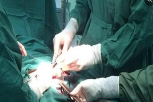 Các bác sĩ đang xử lý trường hợp viêm nhiễm do gắn bi vào dương vật. Ảnh: BV cung cấp