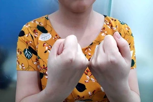 Vỗ tay 36 cái chữa dứt nhiều bệnh hiểm?