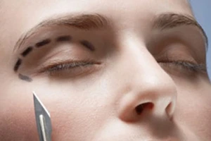 Bắt tay đào tạo để loại dần những bác sĩ thẩm mỹ tay ngang