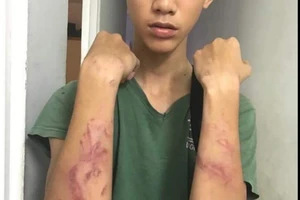 Đề xuất phạt tiền cha dượng đánh con riêng của vợ