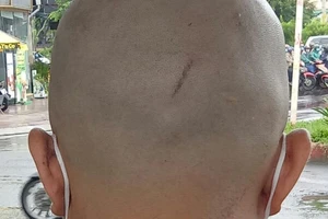 Kỷ luật hộ lý tới nhà đưa bệnh nhân tâm thần đi điều trị