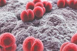 Nam thanh niên nhiễm não mô cầu sau lần đi massage đồng giới 