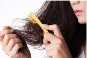 Tóc rụng nhiều sau khi điều trị khỏi COVID-19