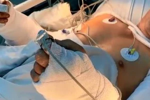 Sơ sẩy một giây, hai cẳng tay đứt lìa