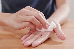 Hay ra mồ hôi tay, phải làm sao?