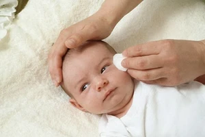 Có nên ngoáy lỗ ghèn để vệ sinh mắt? 