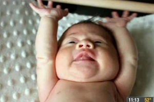 Bé gái sinh ra không có máu