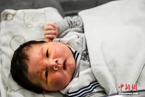 Bé sơ sinh nặng 7,2 kg