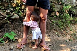 Hai bé tý hon chờ vào Sài Gòn khám bệnh