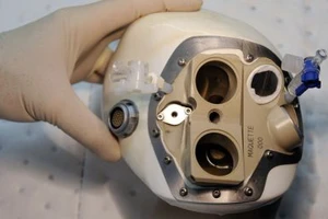 Bệnh nhân được ghép tim nhân tạo đã chết