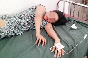 Một phụ nữ bị chủ quán cơm tra tấn dã man