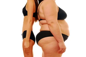 Gầy dễ chết hơn béo