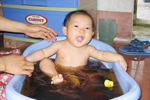 Nên tắm khi bé bị sởi?