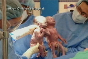 Nắm tay cùng chào đời