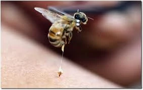 Nọc ong trong châm cứu bệnh Parkinson?