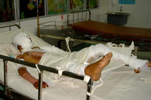 Cháu bỏng nặng vì chú hút thuốc