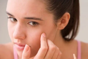 Có nên rạch mụn, hút máu bầm?