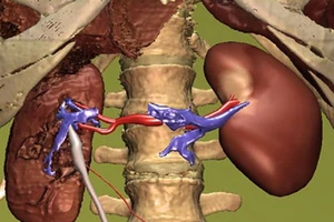 8 thói quen có thể làm hỏng thận của bạn 