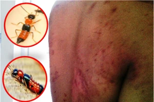 Kiến ba khoang ồ ạt 'tấn công' sinh viên 