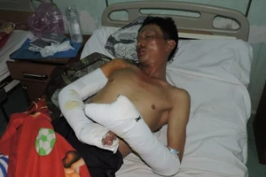 Côn đồ chém loạn xạ trong lễ tân gia, sáu người trọng thương