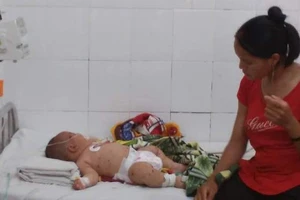 Đắk Lắk: Bé trai năm tháng tuổi nghi nhiễm não mô cầu