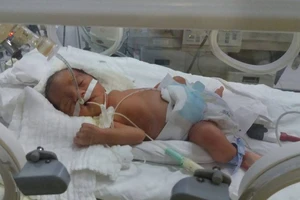 Mổ bắt con, cứu thai phụ bị tai nạn dập phổi