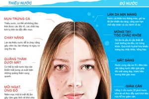 Nhan sắc của bạn bị hủy hoại thế nào khi uống ít nước?